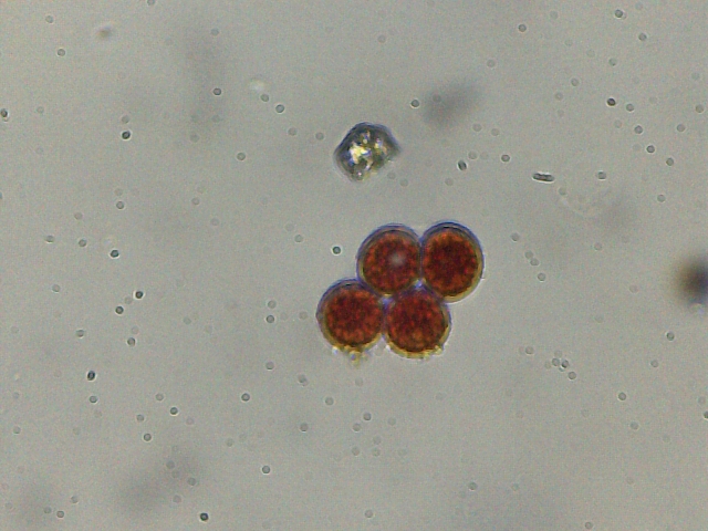 Haematococcus pluvialis e philodina